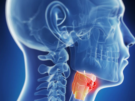 Tumors and Lumps in the Neck and Head | ENT Doctor Cape Town