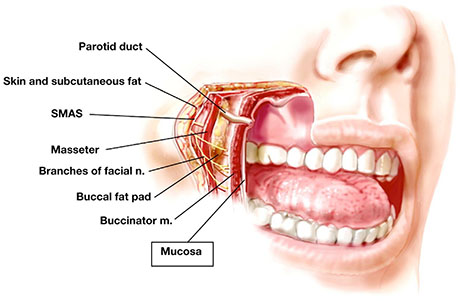 Mucosal Swelling | ENT Doctor Cape Town