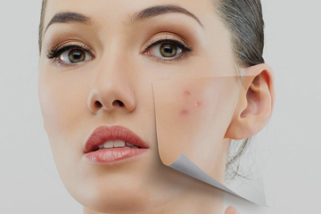 Facial Skin Lesions | ENT Doctor Cape Town