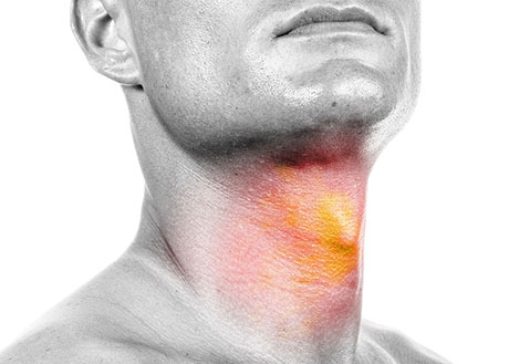 Symptoms of Cancerous Lumps | ENT Doctor Cape Town Symptoms of Cancerous Lumps | ENT Doctor Cape Town