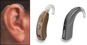 Hearing aids and implants - NHS