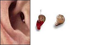 Hearing Aids | ENT Doctor Cape Town