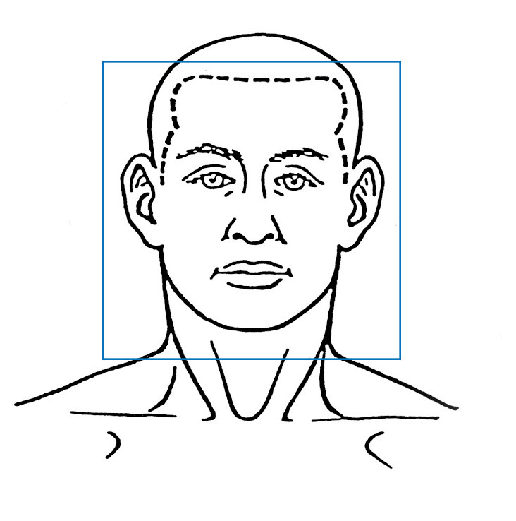 Head Conditions | ENT Doctor Cape Town