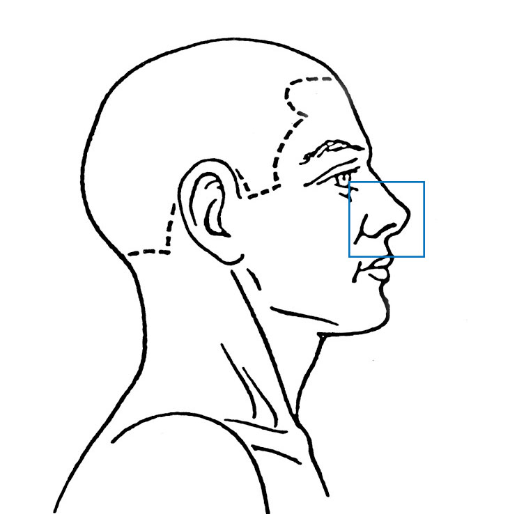 Nose Conditions | ENT Doctor Cape Town