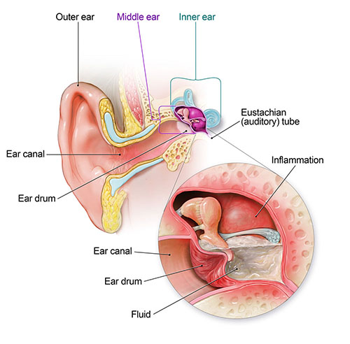 Ear Infection | ENT Doctor Cape Town