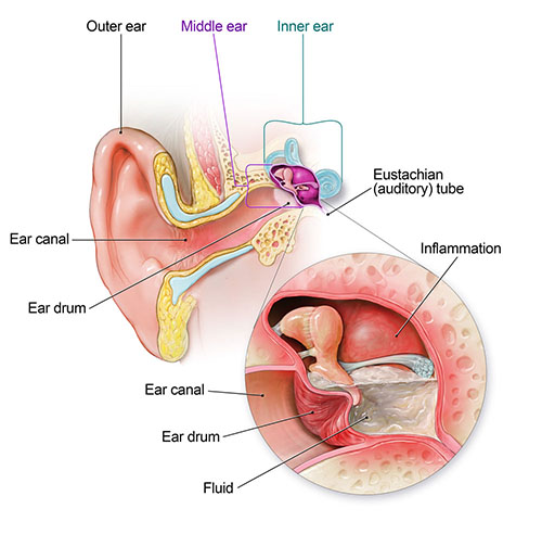 Ear Infection | ENT Doctor Cape Town Ear Infection | ENT Doctor Cape Town