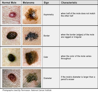 Common Types of Benign Skin Lesions | ENT Doctor Cape Town