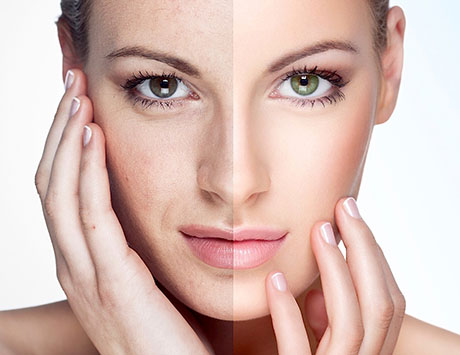 Facial Skin Lesions | ENT Doctor Cape Town
