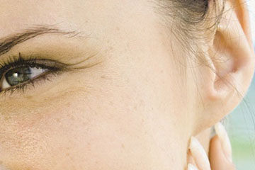 Pinnaplasty | ENT Doctor Cape Town Pinnaplasty | ENT Doctor Cape Town
