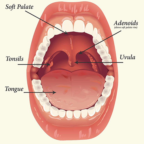 Adenoid Surgery Ent Doctor Cape Town Dr Shabeer Ebrahim