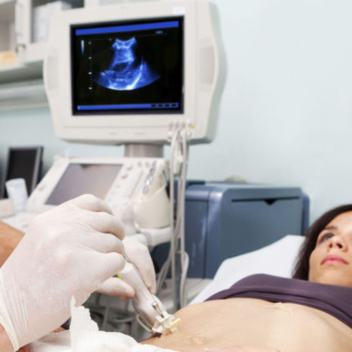 Microlaryngoscopy Results | ENT Doctor Cape Town
