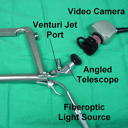 Microlaryngoscopy | ENT Doctor Cape Town