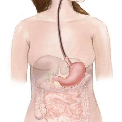 Oesophagoscopy | ENT Doctor Cape Town