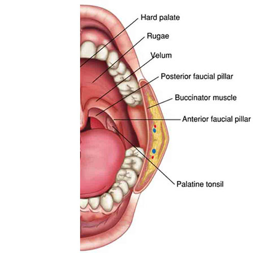 Why Take Tonsils Out | ENT Doctor Cape Town