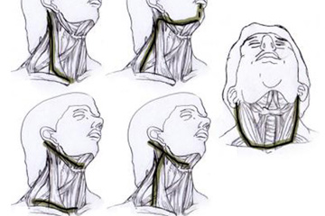 Neck Dissection | ENT Doctor Cape Town