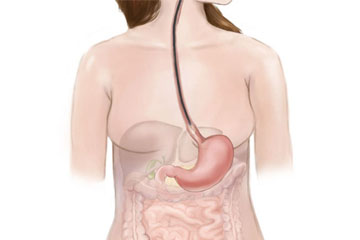 Oesophagoscopy | ENT Doctor Cape Town